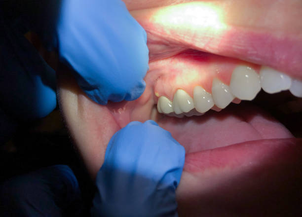 Best Urgent Tooth Repair  in Crystal City, TX